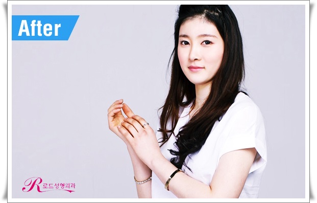까치산역코재수술 변신을 꾀한다면 관련 이미지 3