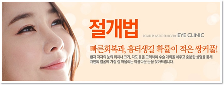 신정역쌍꺼풀수술 아름다운 눈매변화! 로드성형외과 관련 이미지 4