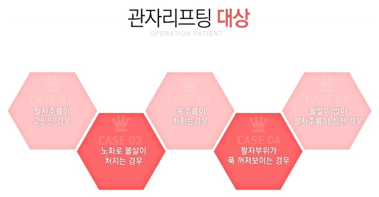 화곡동리프팅으로 살아있는 라인을 관련 이미지 3