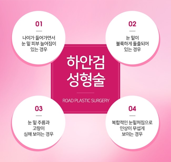 목동눈성형 처진 눈매를 잡아주는 하안검수술! 관련 이미지 3