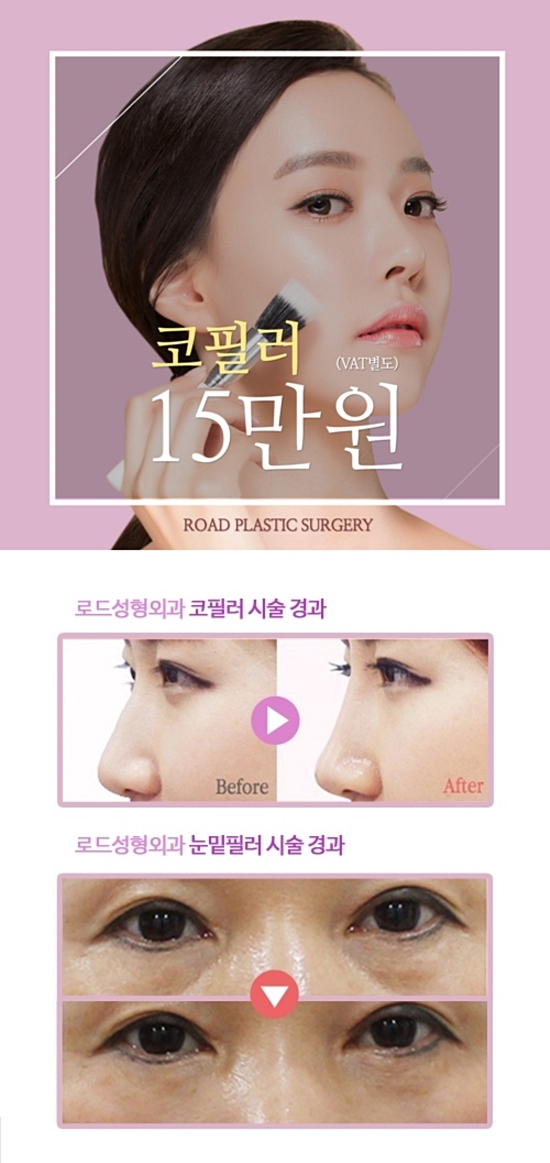로드성형외과 금요일은 보톡스, 필러 DAY! 관련 이미지 3