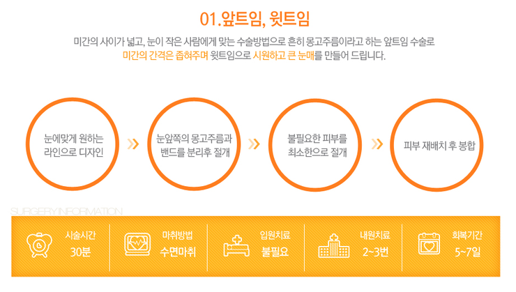 [까치산성형외과 로드성형외과에서 알려드리는 트임성형 정보 ♬] 관련 이미지 4
