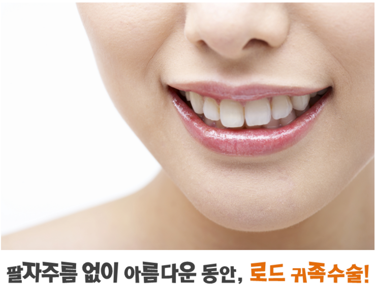 강서구귀족수술 ♬ 아이리스/로드성형외과 관련 이미지 2