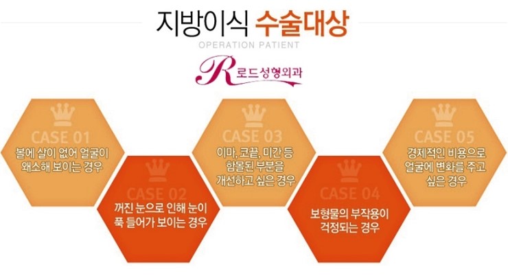 목동역지방이식 애교 얼굴 완성 관련 이미지 4