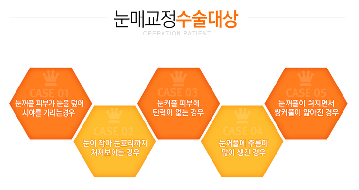 [까치산성형외과 로드성형외과에서 알려드리는 눈매교정 정보 ♬] 관련 이미지 3