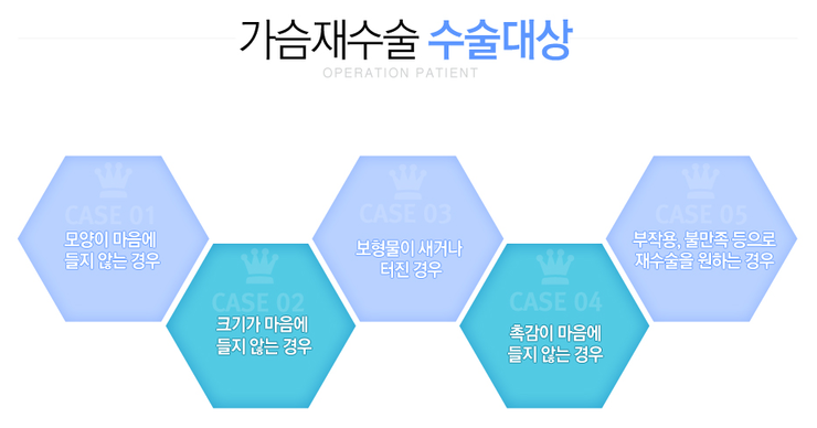 [화곡역성형외과 로드성형외과에서 알려드리는 가슴재수술 정보 ♬] 관련 이미지 3