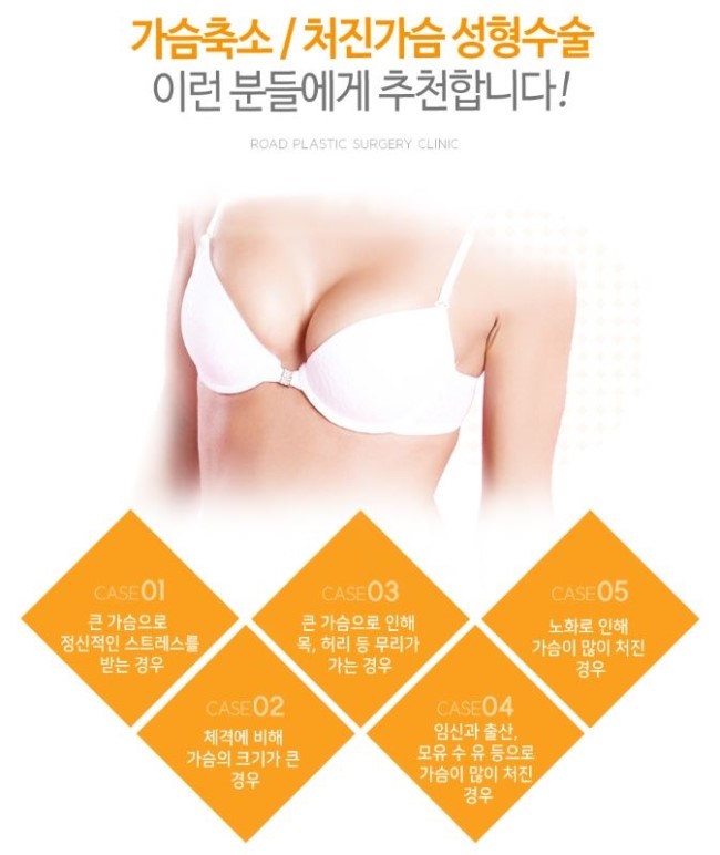 까치산역가슴성형 큰가슴이 고민이라면? 관련 이미지 4