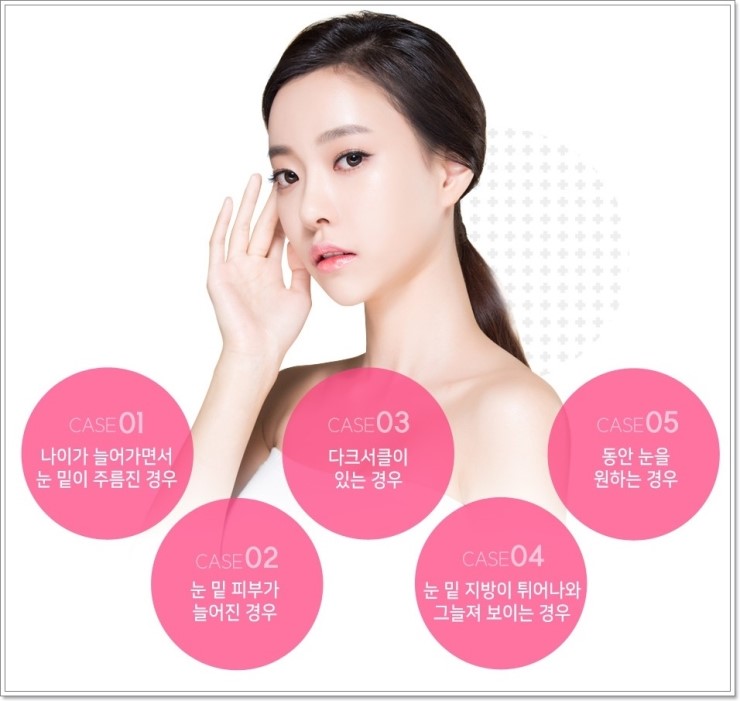 화곡역눈밑지방제거 다크써클 해결하세요. 관련 이미지 2
