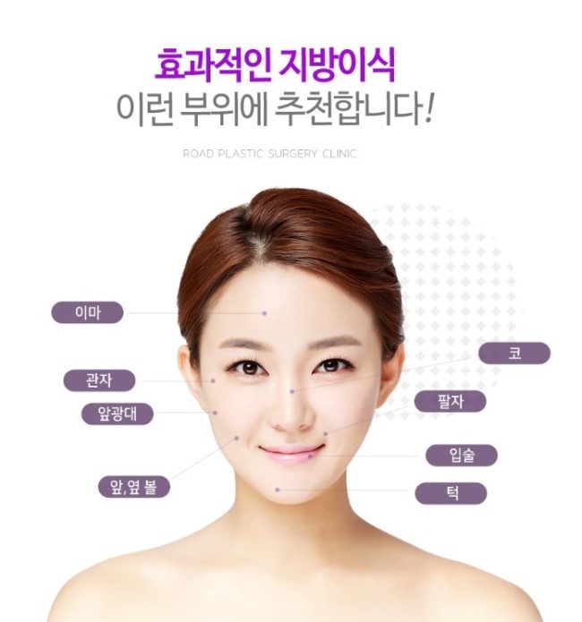 강서구지방이식 입체감이 돋보여요! 관련 이미지 3
