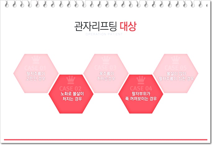 목동성형외과에서 기분 좋게 :> 관련 이미지 3