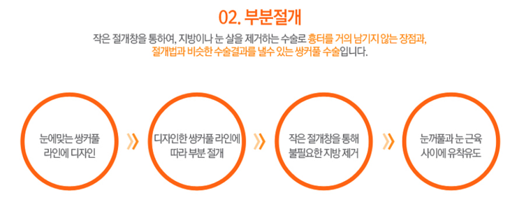 까치산역쌍꺼풀수술 로드에서 특별하게! 관련 이미지 4