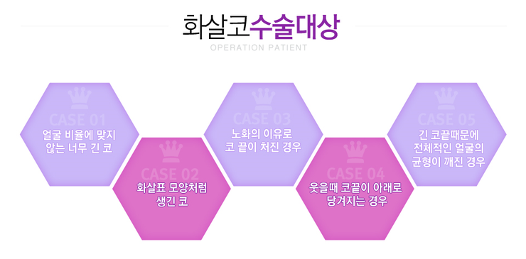 [화곡성형외과 로드성형외과에서 알려드리는 화살코성형 정보 ♬] 관련 이미지 2