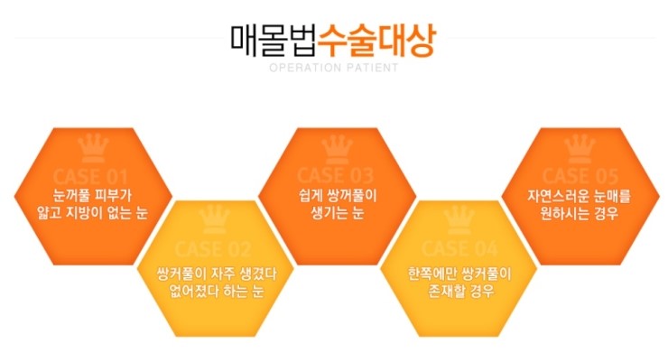 화곡동눈성형으로 나를 변신시키자 관련 이미지 2