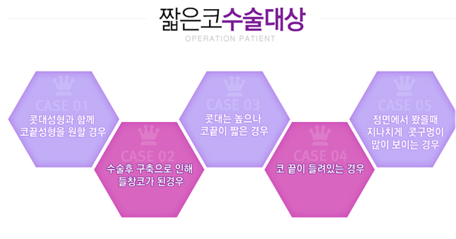 화곡동코성형잘하는곳 확실히 믿자 관련 이미지 3