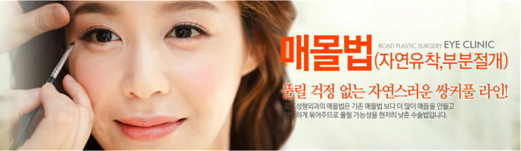 까치산역쌍꺼풀수술 로드에서 특별하게! 관련 이미지 3