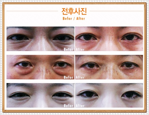 목동역성형외과 달라보이고싶다면 관련 이미지 2