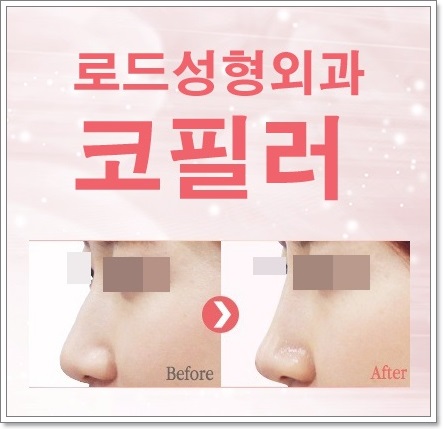 강서구코필러 잘하는곳 자연스러운 코라인으로! 관련 이미지 3