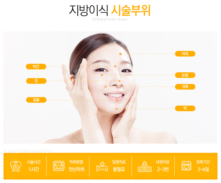 [까치산역성형외과 로드성형외과에서 알려드리는 지방이식 정보 ♬] 관련 이미지 4