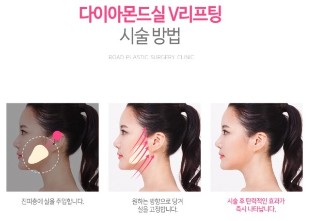 강서구리프팅 살아나는 피부를 원한다면? 관련 이미지 4