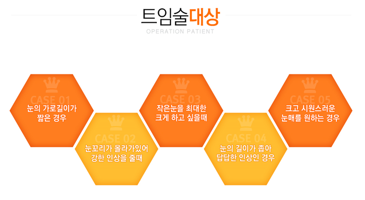 [까치산성형외과 로드성형외과에서 알려드리는 트임성형 정보 ♬] 관련 이미지 3