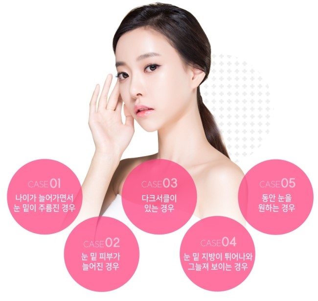 화곡역눈밑지방제거 다크서클까지 확실하게 관련 이미지 3