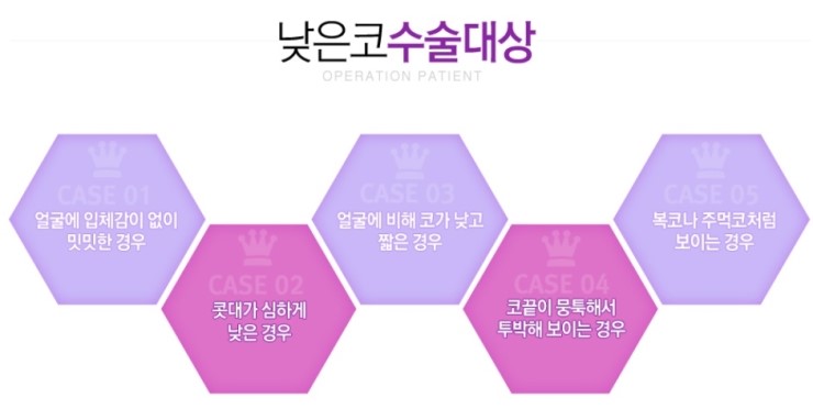 목동역코성형 시원시원한 이미지를 원한다면! 관련 이미지 2
