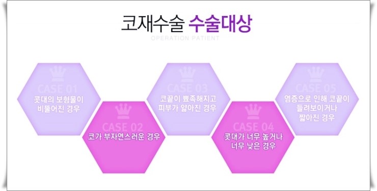 까치산역코재수술 변신을 꾀한다면 관련 이미지 4