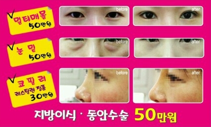 [로드성형외과] 수험생 할인 이벤트 소개! 관련 이미지 3
