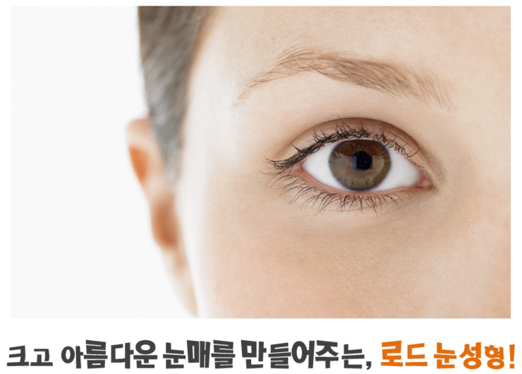 ​[로드성형외과/아이리스성형외과] 강서눈성형잘하는곳 추천 ♬ 관련 이미지 2