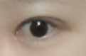 [까치산역성형외과 로드성형외과에서 알려드리는 눈성형 정보 ♬] 관련 이미지 7