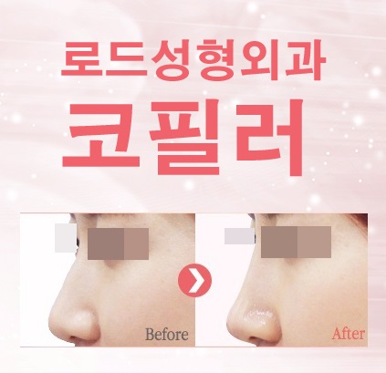 화곡역팔자주름필러 팽팽해졌어요 ! 관련 이미지 3