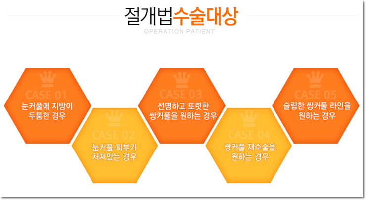 목동쌍꺼풀수술잘하는곳 확실한 선택 관련 이미지 1