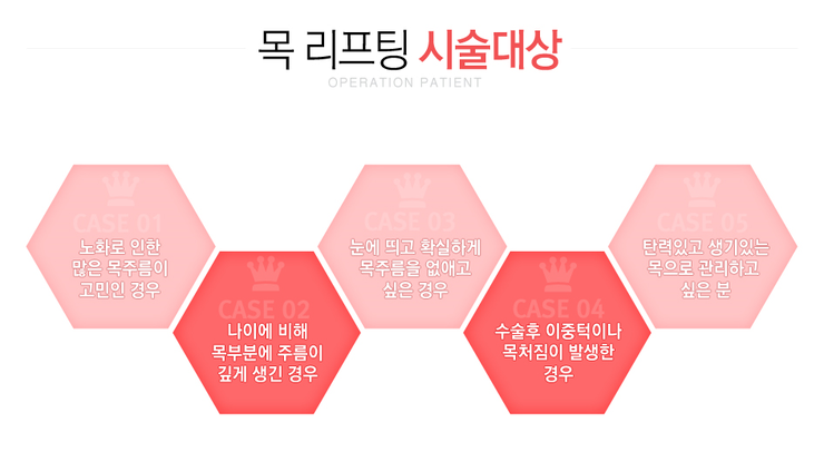 [까치산역성형외과 로드성형외과에서 알려드리는 목리프팅 정보 ♬] 관련 이미지 2