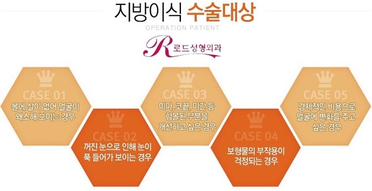 목동역지방이식잘하는곳 알기 관련 이미지 4