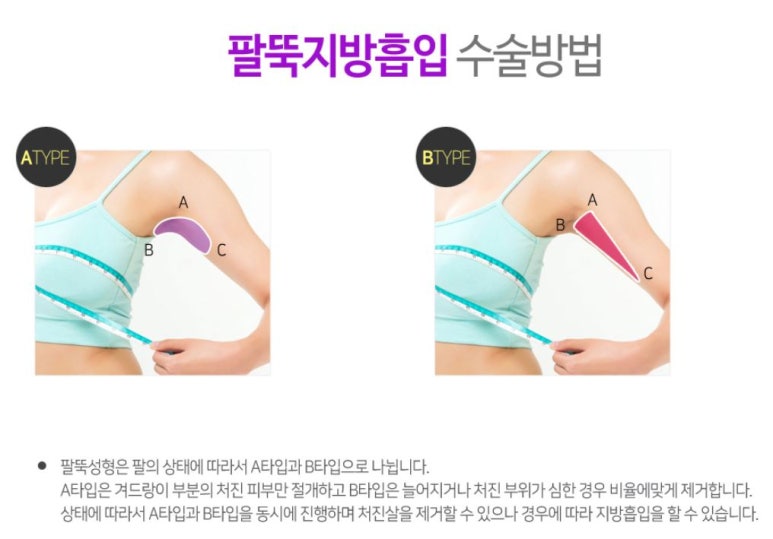 화곡동지방흡입 잘하는곳 찾는다면 로드에서! 관련 이미지 3