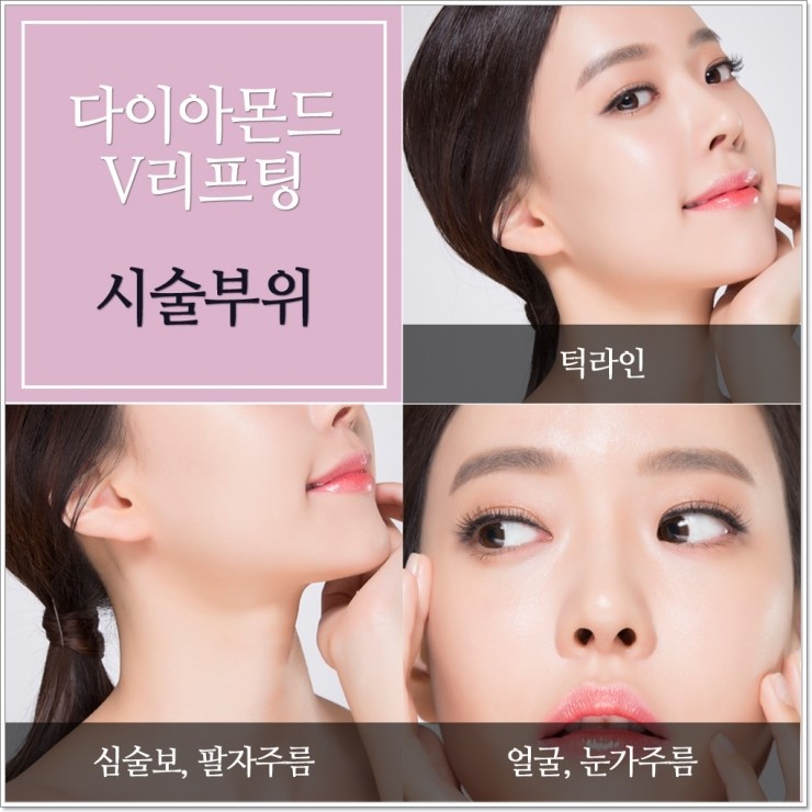 목동리프팅 다이아몬드실 V리프팅으로 탄력있게! 관련 이미지 2