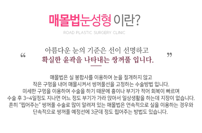 까치산역쌍꺼풀수술 절개 없이 가능할까? 관련 이미지 2