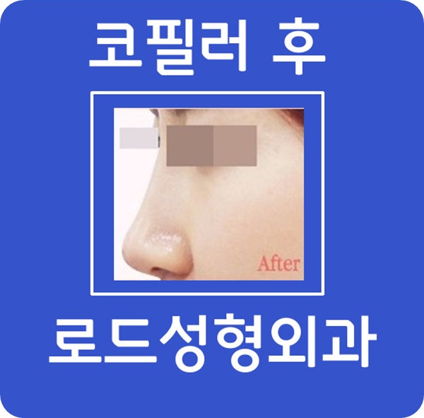 신정역코필러 매끄러운 모양을 살리다! 로드성형외과 관련 이미지 2