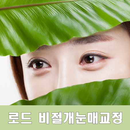 강서구비절개눈매교정 추천 ♬ 아이리스/로드성형외과 관련 이미지 1
