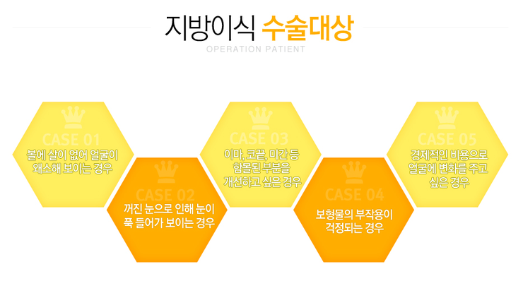 [까치산역성형외과 로드성형외과에서 알려드리는 지방이식 정보 ♬] 관련 이미지 2