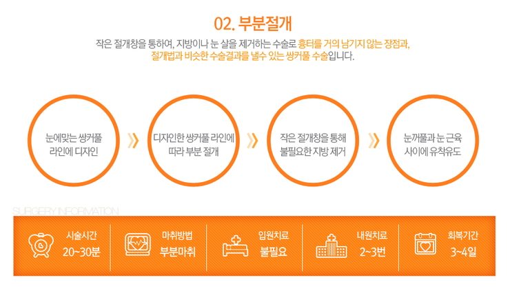 [까치산역성형외과 로드성형외과에서 알려드리는 눈성형 정보 ♬] 관련 이미지 5