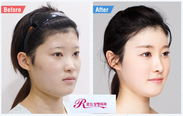 신정역코성형 잘하는 곳에서 라인 UP! 관련 이미지 3