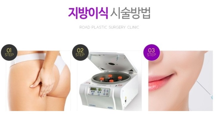 강서구지방이식 놀라워라 관련 이미지 3
