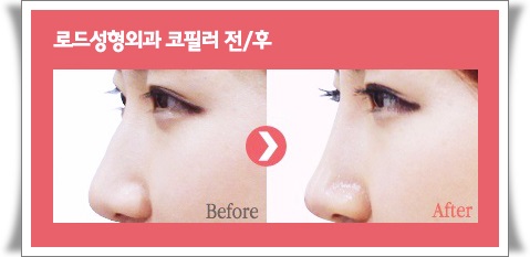 화곡동코필러 내가 찾던 결과 관련 이미지 2