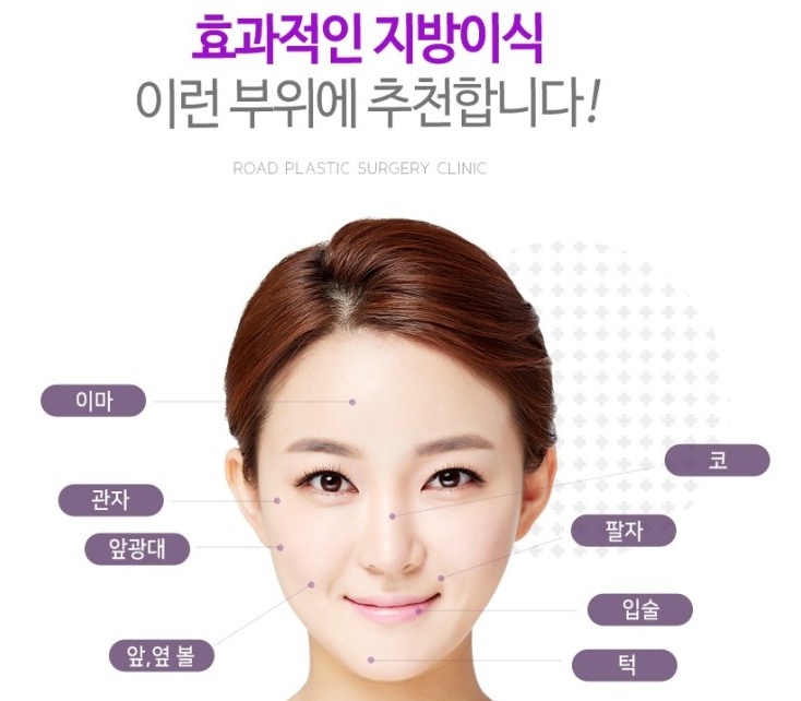 강서구지방이식 놀라워라 관련 이미지 4