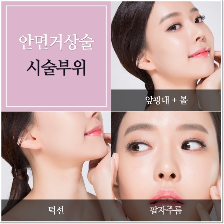 목동역안면거상술 동안성형의 가장 확실한 방법! 관련 이미지 2