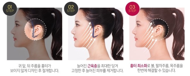 강서구리프팅 부러워할만해 관련 이미지 4