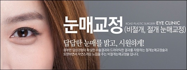 신정역비절개눈매교정 칙칙함을 벗기자! 로드성형외과 관련 이미지 1