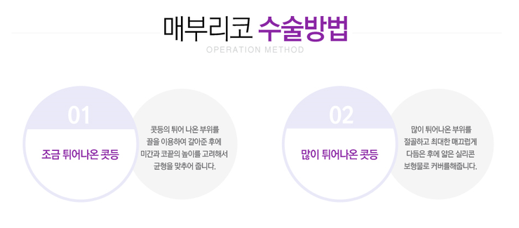[까치산성형외과 로드성형외과에서 알려드리는 매부리코성형 정보 ♬] 관련 이미지 3