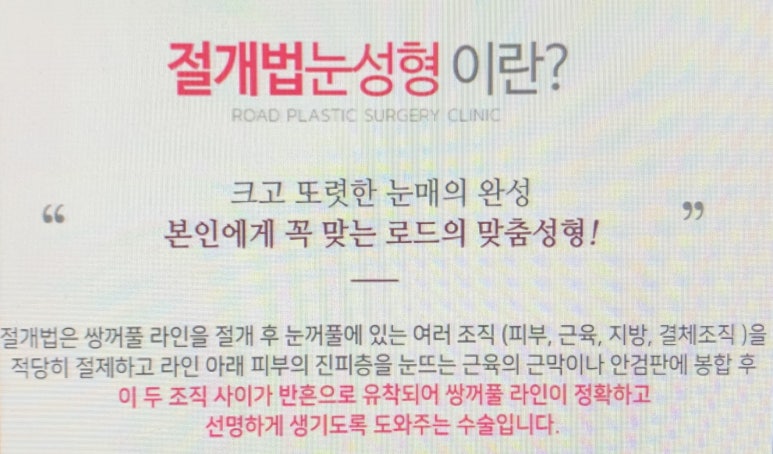 목동쌍꺼풀수술 어디서하면 좋을까? 관련 이미지 1